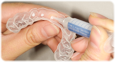 マウスピースにティオンホームプラチナを流し込みます。