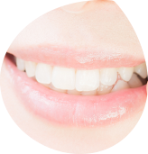 ホワイトニング