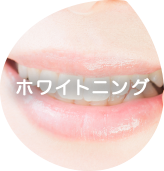 ホワイトニング