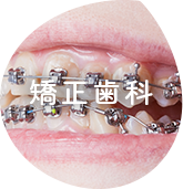 矯正歯科